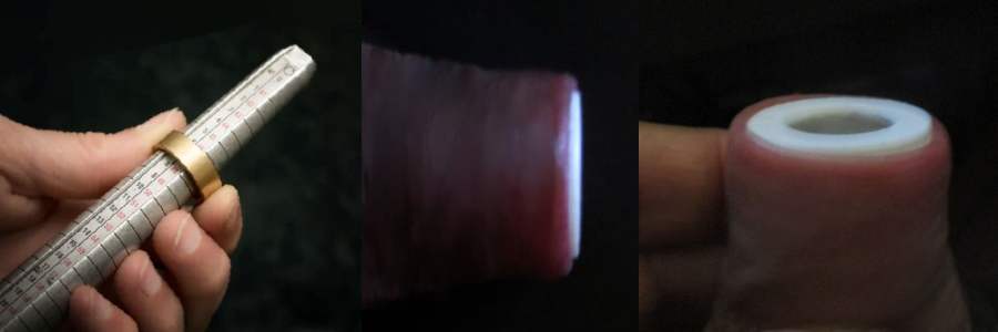 Conos extensores para fimosis, solución prepucio apretado adultos